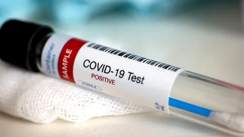 Coronavirus România, 19 iunie 2021. 63 de cazuri noi SARS–CoV–2 s-au înregistrat, în ultimele 24 de ore