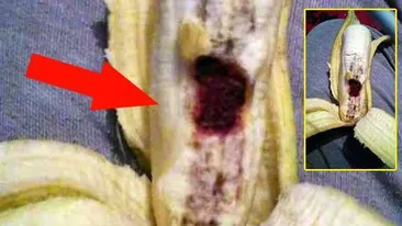 O fetiţă din Giurgiu a cumpărat banane şi când a ajuns acasă mama ei a desfăcut una şi a avut un şoc: ”Banane injectate cu sânge cu HIV”