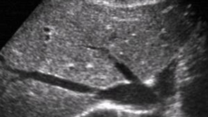 Medicii au ramas socati dupa ce au descoperit ce se afla in burta acestei femei: "Nimeni nu-i dadea nicio sansa"