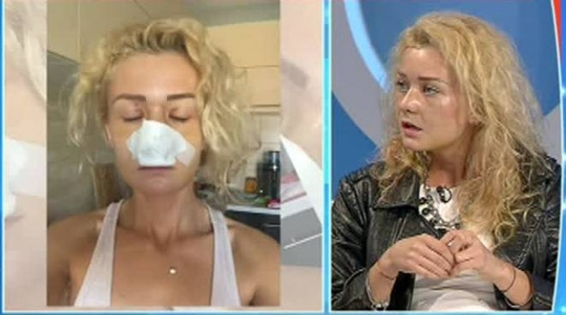 SANDRA, „blonda lui TUNCAY“, desfigurată! I-a dat cu piciorul în faţă, când pleca din club