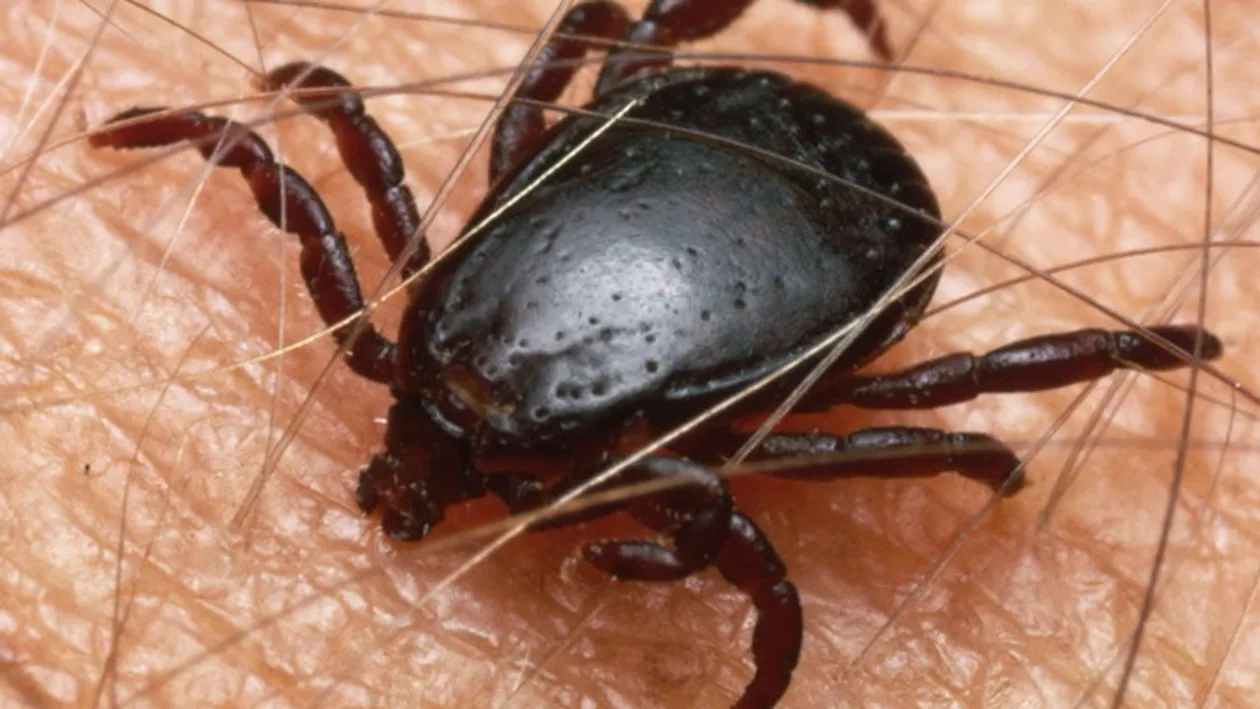 Atentie, incepe sezonul capuselor! Specialistii ne invata cum sa ne ferim de acest pericol!