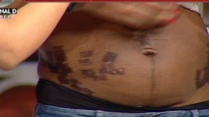 Video INCREDIBIL! Uite in ce hal a fost mutilata Laurette la salonul de infrumusetare - Are carne vie pe abdomen