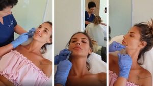 Ramona Olaru, prima intervenție estetică la față. Cum arată acum asistenta matinalului de la Antena 1