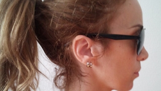 Annes a fost arsa pe gat cu ondulatorul de catre hair stylista! Cantareata se trateaza acum cu sange de vitel!