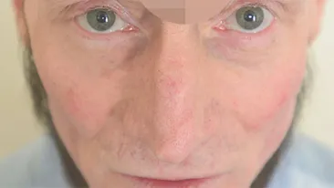 A primit 450 de refuzuri de la angajatori intr-un an! Motivul pentru care nu l-a vrut nimeni pe acest barbat se afla fix pe frunte