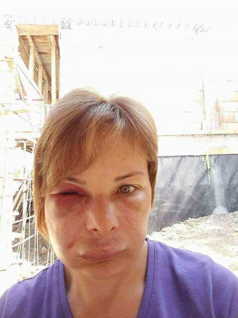 O femeie din Bacău ar fi fost mutilată de stomatolog