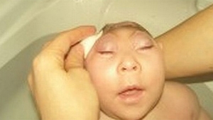 CUTREMURĂTOR! Cum s-a născut această copilă, pentru ca mama ei a consumat droguri in timpul sarcinii! Imagini greu de privit