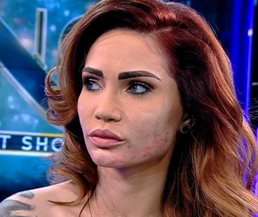 Maria Ilioiu, declarații de coșmar după ce a fost mutilată la „clinica vedetelor”: „Fața mea este tăbăcită, cu gropi”
