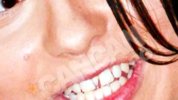 Inna a stat cu un dintisor in plus pana sa fie vedeta