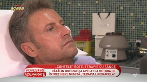 Botezatu a apelat la un tratament rupt din seria "Twilight"! Îşi injectează propriul sânge în faţă pentru un ten cât mai tănăr!