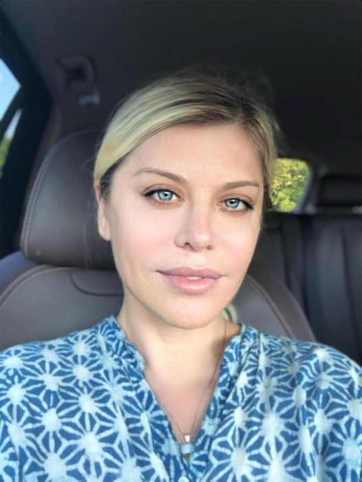 Loredana Groza a vorbit despre operațiile estetice pe care le are