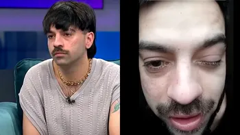 David Pușcaș s-a trezit cu ochiul umflat și a avut un șoc când s-a uitat în oglindă: ”Am vreo boală?”