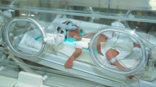 Imagini greu de privit! Medicilor nu le-a venit sa creada cand au vazut cum arata acest bebelus