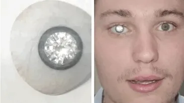 Povestea tânărului care și-a pus un diamant de 2 milioane de dolari în loc de ochi: ”A adus o lumină nouă în viața mea”