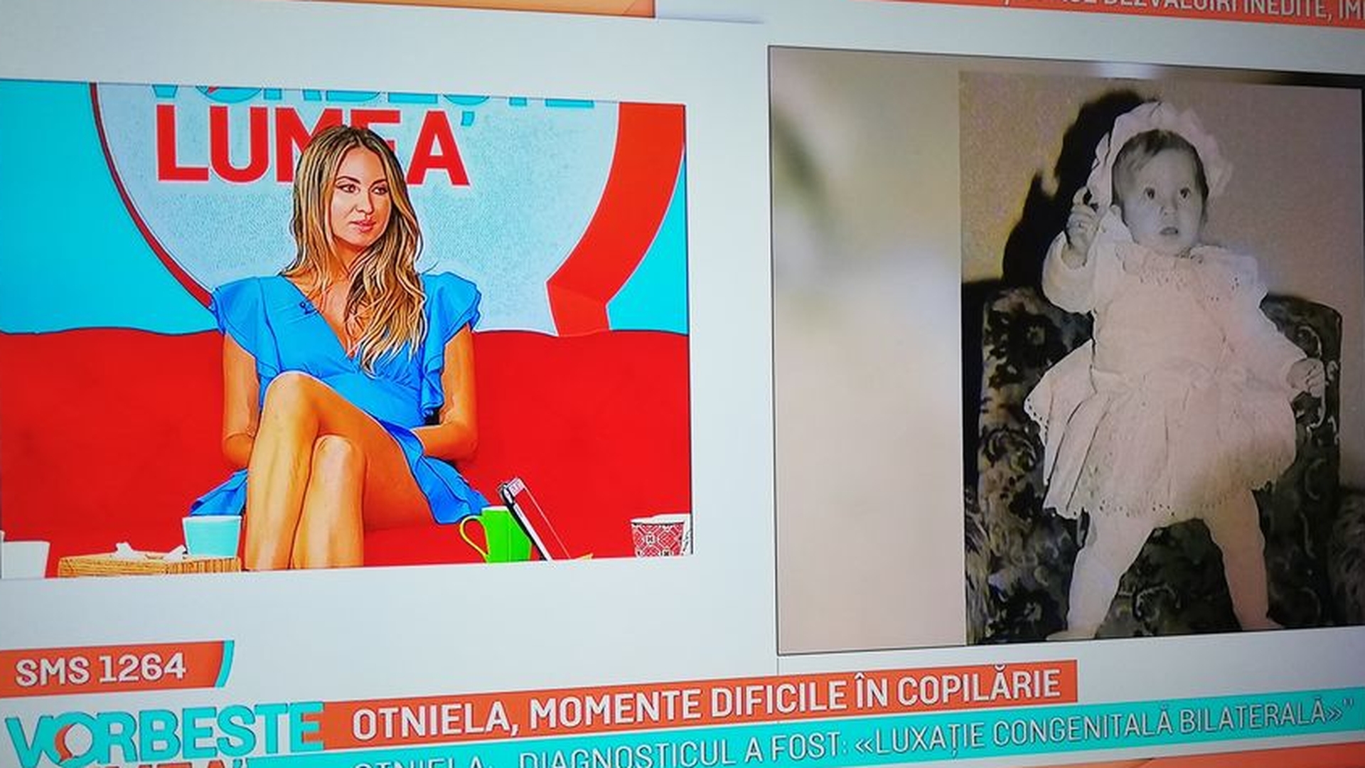 Otniela, dezvăluiri tulburătoare: ”Am avut un picior mai scurt!” Când a făcut primii pași