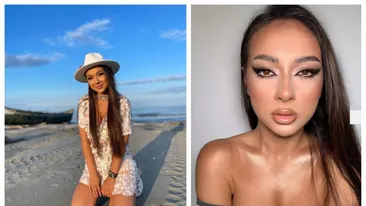 Vlăduța Lupău a ajuns la medic. Ce intervenție estetică și-a făcut artista: „Pielea va fi întinsă ca la 15 ani”. FOTO