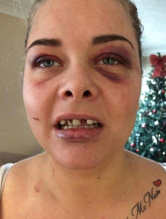 Un bărbat și-a bătut iubita și i-a spart trei dinți din cauză că a schimbat poza de pe Facebook și el nu mai apărea în ea