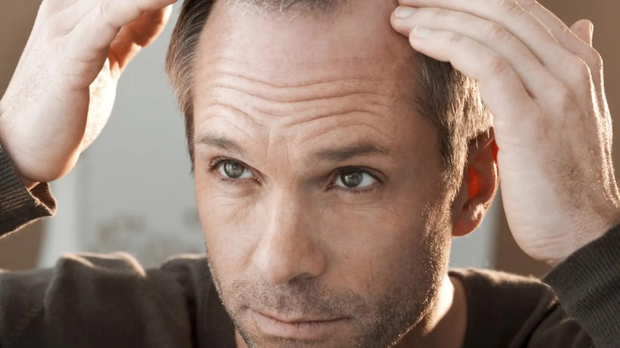 Oamenii de ştiinţă au găsit în sfârşit răspunsul: Iată de ce unii bărbaţi ajung să chelească