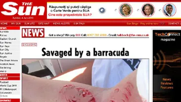 O stiuca de mare aproape ca i-a sfartecat bratul unei adolescente!