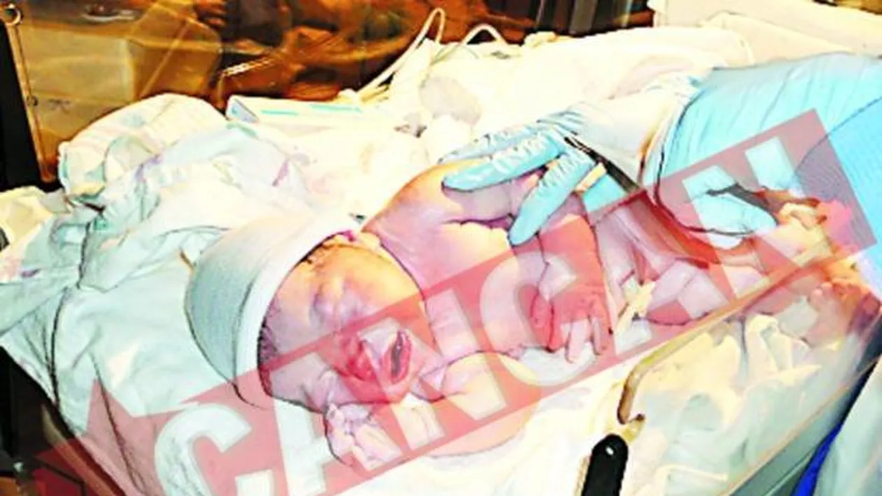 S-a nascut in coma alcoolica