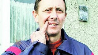 Postasul a simtit pe pielea lui riscurile meseriei. A ramas fara dinti ca a adus vesti proaste