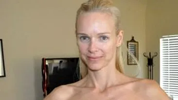 Imagini şocante! Cum arată un fost model după ce si-a tăiat sânii pentru a scăpa de cancer: Mă simt femeie