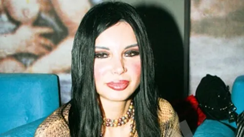 Vedetele autohtone, dependente de interventiile nechirurgicale