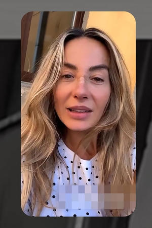 Cum arată Flavia Mihășan la 3 săptămâni de la operația la nas. Vedeta e schimbată total!