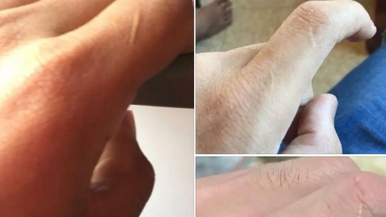 Ce înseamnă dacă ai o cicatrice pe degetul de la mâna stângă: „Persoana care te-a iubit în viața anterioară nu....”