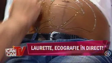 VIDEO PREMIERA! Ecografie in direct! Laurette si-a vazut copilul nenascut pe post!