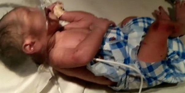 O fetiţă nou-născută a fost abandonată la gunoi de părinţi! Motivul halucinant pentru care au lăsat-o să o mănânce furnicile