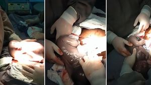 Imagini emoționante în sala de operații: un băiețel s-a născut în timp ce era încă în sacul amniotic. Cazul este foarte rar: 1 la 80.000 de nașteri | FOTO & VIDEO