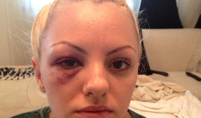 Alexandra Stan, dezvăluiri despre bătaia pe care a primit-o de la Marcel Prodan. " Ca să ajungi agresor, ai și tu niște probleme emoționale… " + Cum a reușit să depășească perioada neagră din viața ei 