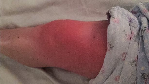 Pare o tânără obişnuită, dar suferă de o boală rară din cauza căreia are dureri cumplite: „Un om normal nu ar putea suporta”