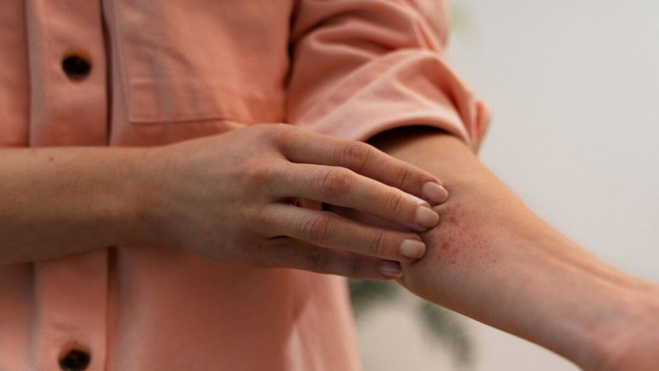 (P) Tratament pentru psoriazis ușor de urmat și integrat în rutina zilnică. Remisie îndelungată și efecte vizibile rapid