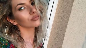 LIDIA BUBLE a dat cărţile pe faţă! A apelat artista la medicul estetician?