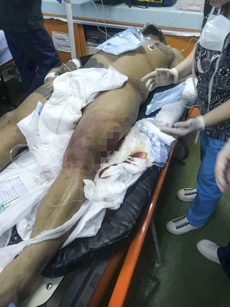 Bebino, la scurt timp după ce a ajuns la spital