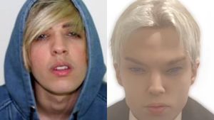 Un actor celebru a murit din cauza unei operații estetice. A cheltuit 220.000 de dolari ca să arate precum idolul său