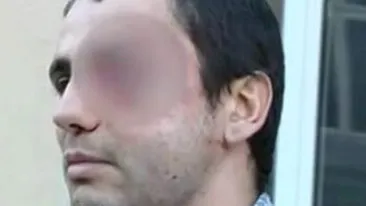 I-au scos ochiul unui barbat pentru a se razbuna pe sora acestuia!