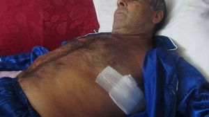 Bătaie ca-n beciurile Miliției. Doi polițiști și un jandarm din Iași care i-au rupt cinci coaste și o vertebră unui bărbat audiat au fost condamnați la închisoare