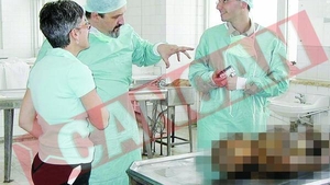 A facut hepatita din cauza formolului