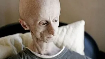 INCREDIBIL! Omul-Extraterestru traieste in Africa si are 25 de ani!