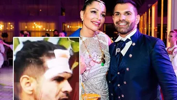 Florin Pastramă, bătut cu bestialitate în București! Soțul lui Brigitte are fața tumefiată