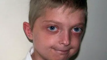 Are 11 ani, dar arata de 40! Un copil traieste clipe de cosmar