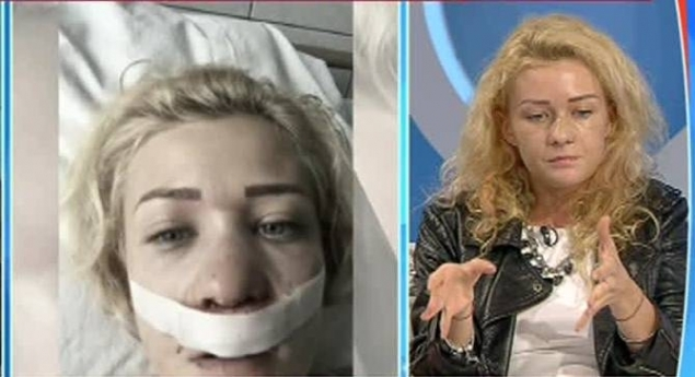 SANDRA, „blonda lui TUNCAY“, desfigurată! I-a dat cu piciorul în faţă, când pleca din club