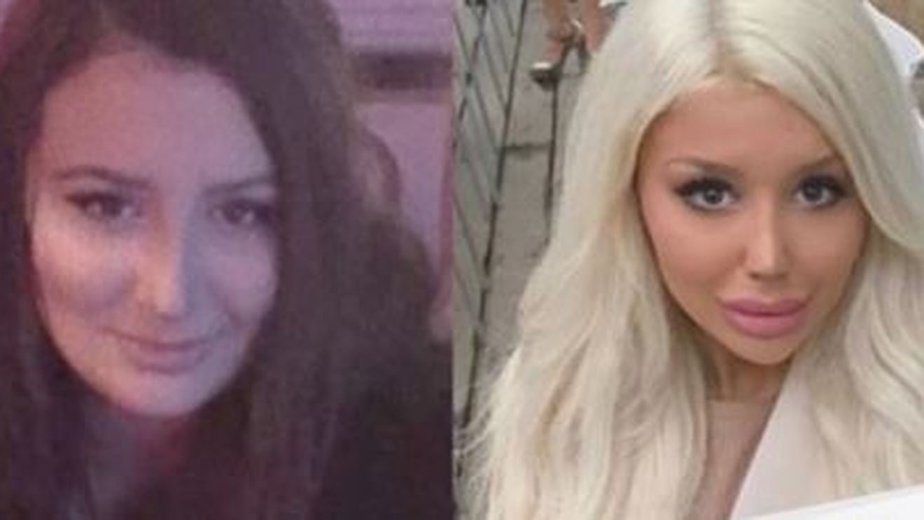 A cheltuit o avere pentru a arăta ca păpușa Barbie. Mărturiile unei tinere dependentă de operațiile estetice
