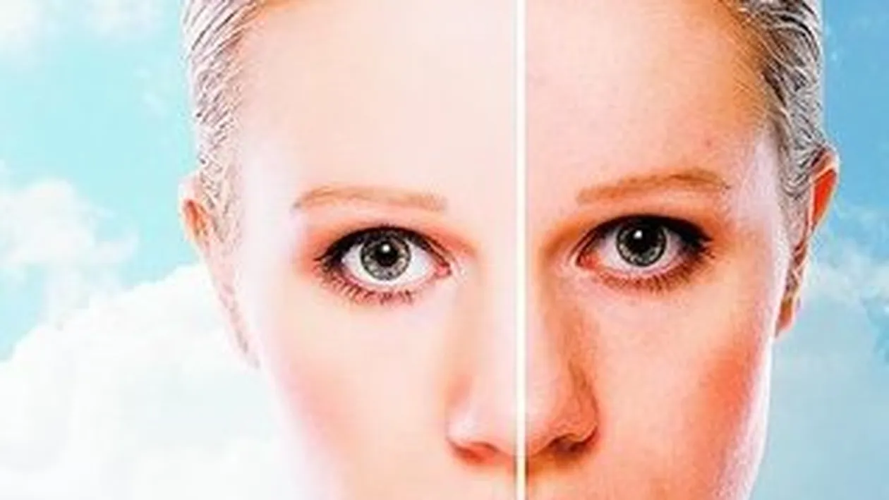 Cum afecteaza ultravioletele epiderma. Ridurile si soarele