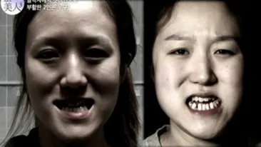 VIDEO Transformare de zile mari! Cum arată aceste gemene urâţele după ce au intrat pe mâna specialistilor. Nu le mai recunosti