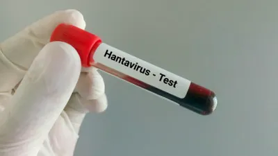 Ce este hantavirusul, infecția care a provocat trei decese pe o navă de croazieră. Ce riscuri există în România