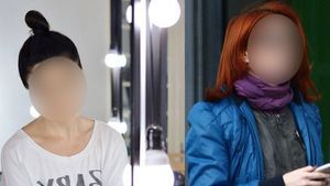 Cântăreaţa care a rămas fără viaţă socială din cauza acneei! "Te afectează la nivel social, nu am vrut să merg la concerte!" Cine a trecut prin drama aceasta